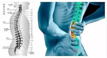 这样改善腰椎间盘突出，想不好都很难（图）_3