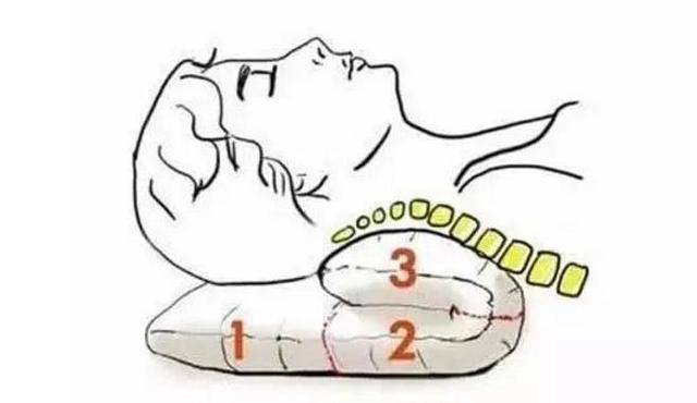 關(guān)于頸椎病的錯(cuò)誤觀(guān)點(diǎn)_1