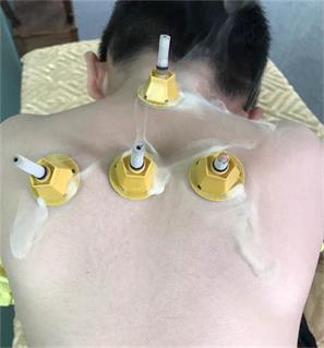 艾灸貼值得買嗎？感恩艾艾灸貼的使用感受來自一位網友的評測（圖）_7