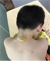 艾灸貼值得買嗎？感恩艾艾灸貼的使用感受來自一位網友的評測（圖）_9