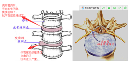 頸椎病頭暈一般最佳的改善方法是什么？_2