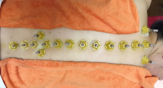 艾灸的作用，艾灸貼有什么作用？_2