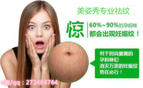 想問問，美姿秀用多久妊娠紋才會去掉？有沒有用過的（圖）_1