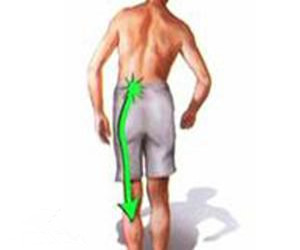 腰椎間盤(pán)突出怎么辦？髓核突出是主要病理表現(xiàn)_1