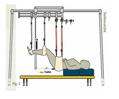 為什么說腰間盤突出不難治？你卻治不好原因是沒用對(duì)方法!（圖）_4