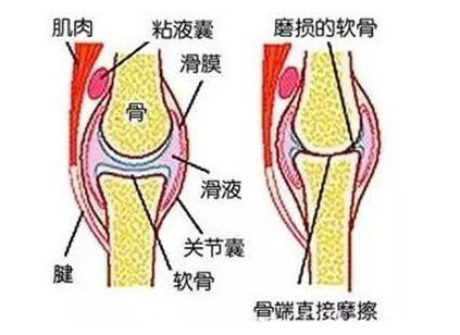 你有滑膜炎就用王九正黑膏藥來治改善果好！_2