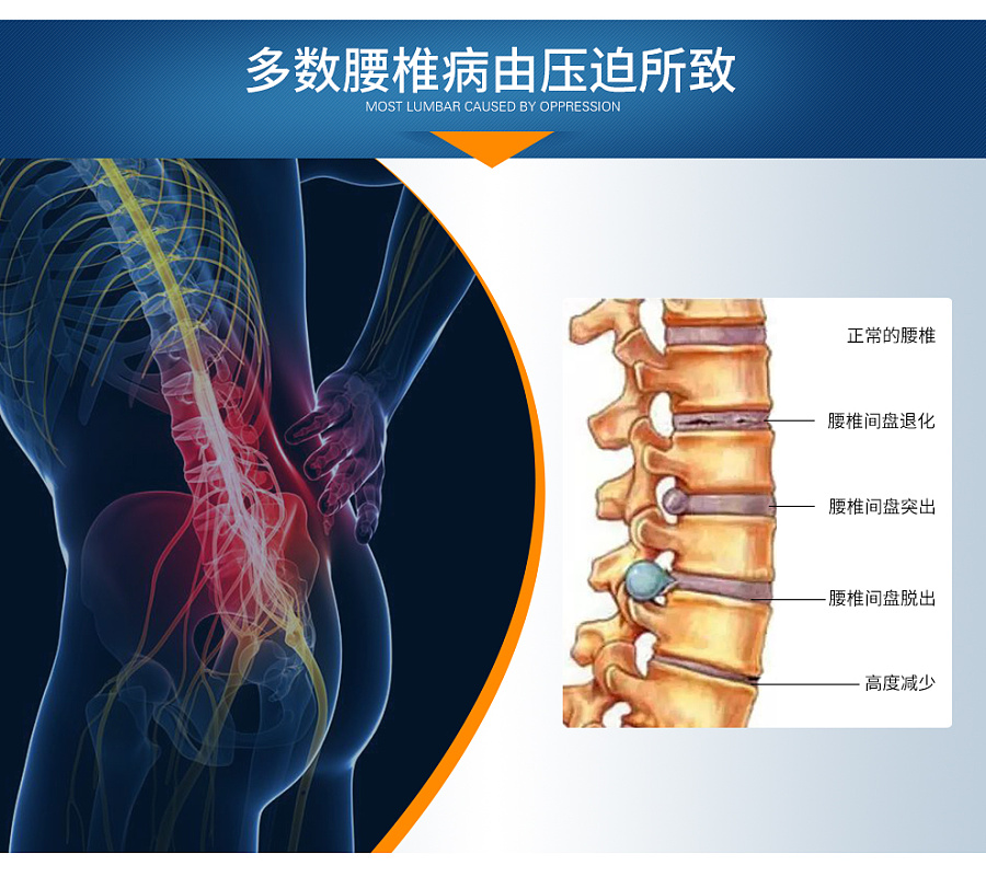 不想被腰椎間盤突出疼痛日夜折磨？我們該怎么辦？_2