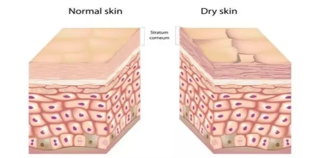 皮肤管理：为什么有时候皮肤越补水越缺水？（图）_2