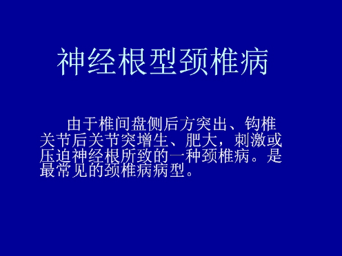 治神經(jīng)根型頸椎病最管用的改善方法全靠它（圖）_1
