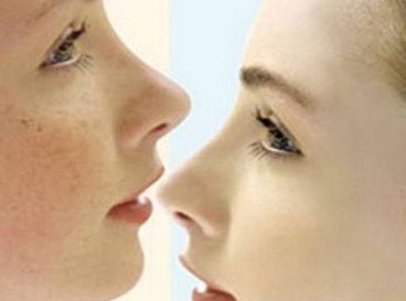 美容院e光美容儀多少錢一臺（圖）_2