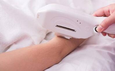 哪款激光脫毛儀器好（圖）_1