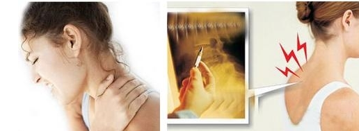 頸椎病改善有竅門，趕緊學(xué)起來(lái)一起做！（圖）_1