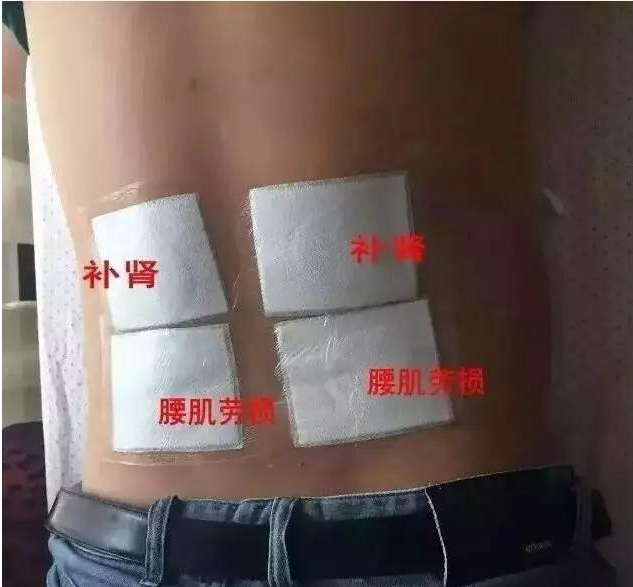 快速緩解腰肌勞損的方法讓王九正醫(yī)師講解下（圖）_4