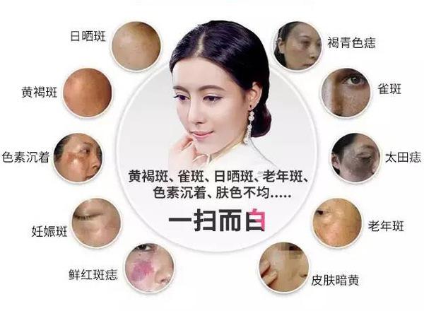 皮秒儀器多少錢一臺（圖）_2