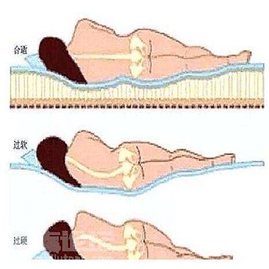 針對腰間盤突出日常該如何有效的去改善_2