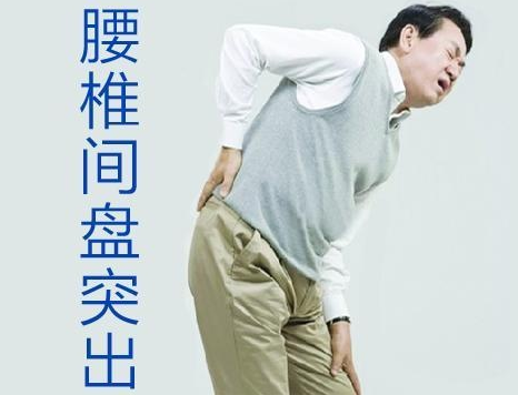 改善腰間盤突出的妙招中這個方法我最認可?。▓D）_1