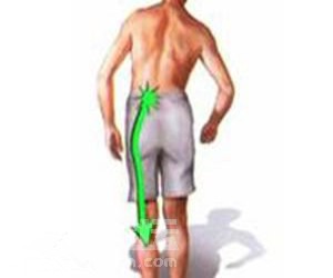 腰椎間盤突出90%都可以這樣保守改善好_1