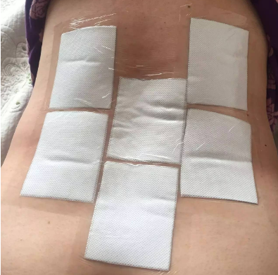 腰間盤突出要怎么做呢？如何有效治我有話說（圖）_4