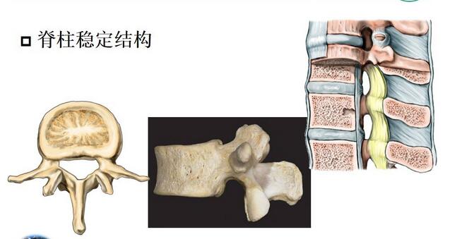 不用做手術(shù)就可以治好腰間盤突出的方法有哪些？我推薦王九正遠(yuǎn)紅外理療貼！（圖）_1