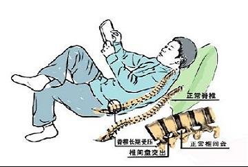 改掉這些壞習(xí)慣，配合這個(gè)方法，腰椎間盤突出不再是問(wèn)題（圖）_2
