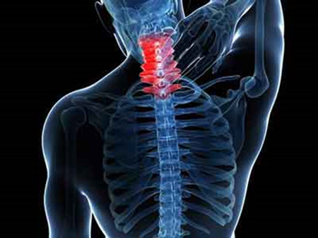 改善頸椎病最佳的保守方法原來是這個（圖）_3