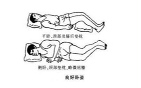 腰椎間盤突出癥的自我療法？在家治腰椎突出？_1