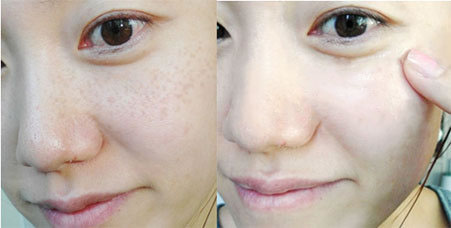 口服祛斑最好的產(chǎn)品（圖）_3