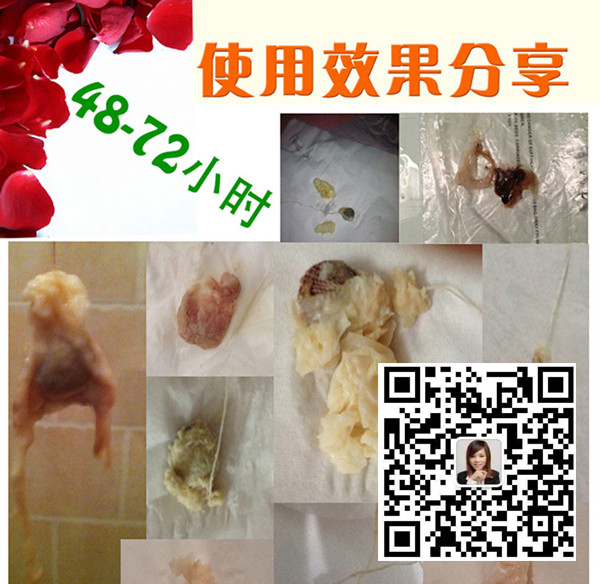 女人為什么非常有必要使用私護產(chǎn)品？看完就懂了?。▓D）_2