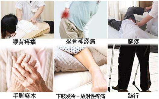 腰椎間盤突出別在吃藥了中藥外貼才見效_2