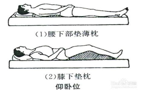 腰椎間盤突出折磨你這么久了，還沒好？那是你還沒遇到它！_3