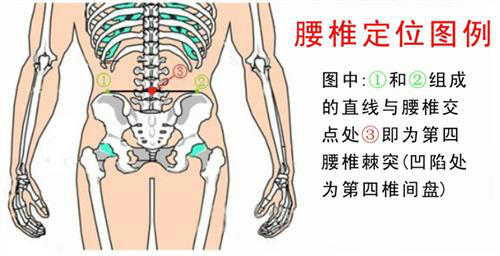 腰椎间盘突出腿部发麻该怎么改善？（图）_2