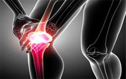 如何有效預(yù)防風(fēng)濕性關(guān)節(jié)炎？如何改善好呢？（圖）_1