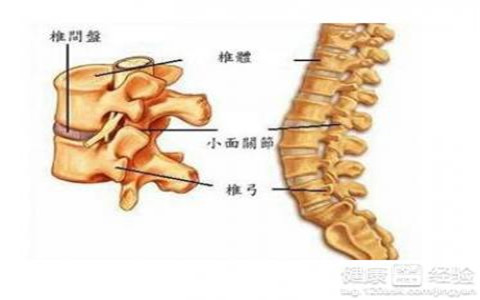 腰椎間突出這些人易中標(biāo)？你有嗎？（圖）_2