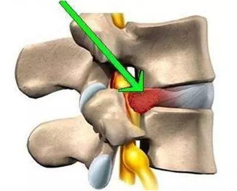 這個膏藥太好用！王九正黑膏藥150/盒，450/療程3盒（圖）_1