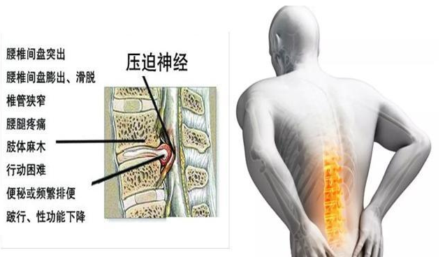 這個膏藥太好用！王九正黑膏藥150/盒，450/療程3盒（圖）_2