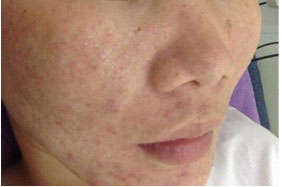 加盟韓方科顏祛痘美容院好不好？_8