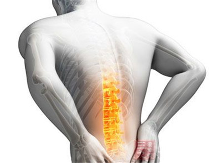 目前改善腰椎間盤突出最好的方法是什么？_1
