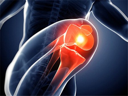 膝關(guān)節(jié)疼痛貼什么膏藥治改善果好？_1