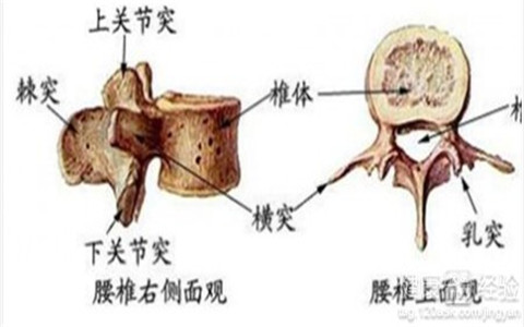 治愈腰椎间盘突出原来只需这么简单！（图）_3