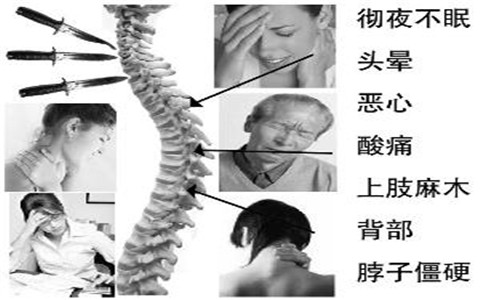 想要睡的好，又能改善頸椎病，看這里，有好招！（圖）_2