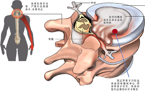 想要睡的好，又能改善頸椎病，看這里，有好招?。▓D）_3