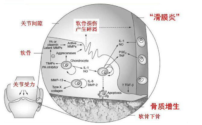 滑膜发炎有积液改善的方法是什么呢？（图）_2