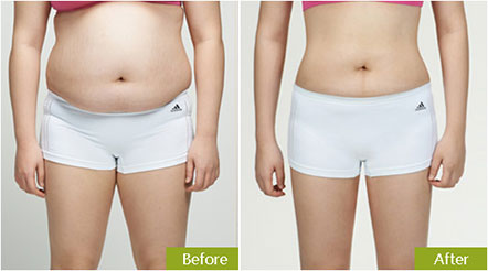 電腦減肥儀器哪款效果好電腦減肥儀器排行榜（圖）_3