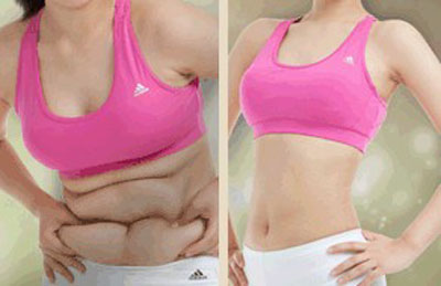 電腦減肥儀器價格新款美容院電腦減肥儀器多少錢一臺（圖）_2