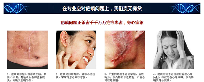 除疤去痘印_1