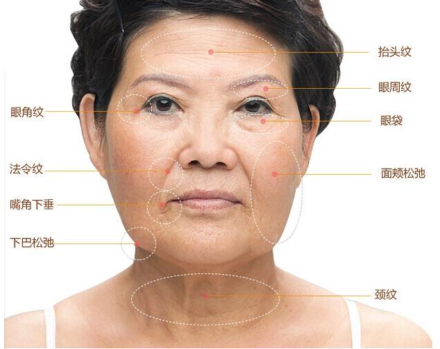 提拉緊致儀器多少錢一臺(tái)提拉緊致儀器價(jià)格(圖)_3