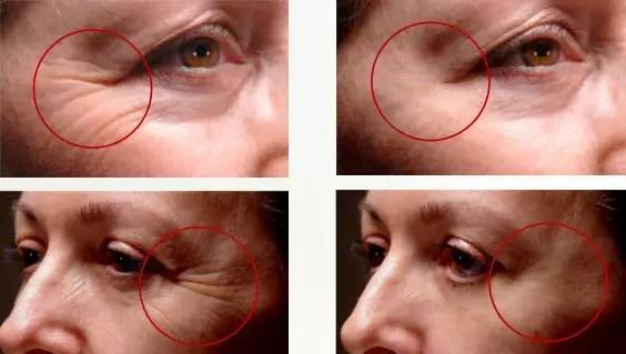 美容超聲刀價(jià)格多少錢一臺(tái)（圖）_3