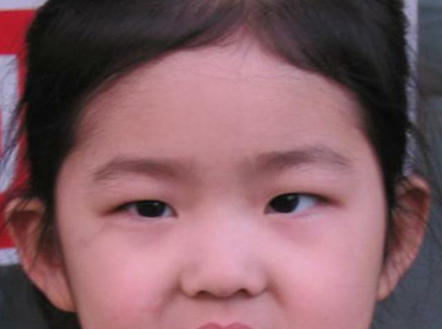 經(jīng)常眨眼的小朋友注意啦,看看是不是有這些癥狀（圖）_1