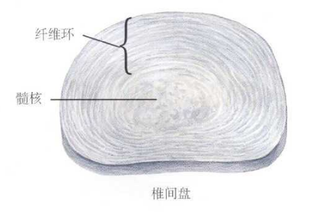 腰間盤突出能否治好如何治改善果好？（圖）_1