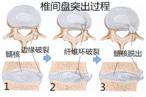 如果你有以下情况，强烈建议你看看_3